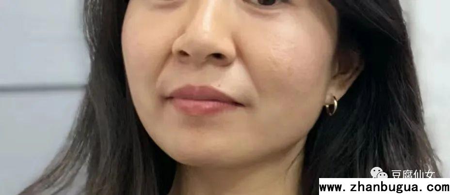 五官相面學——法令紋