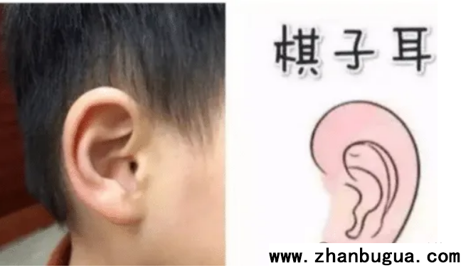 面相深论之“耳朵”系列—01