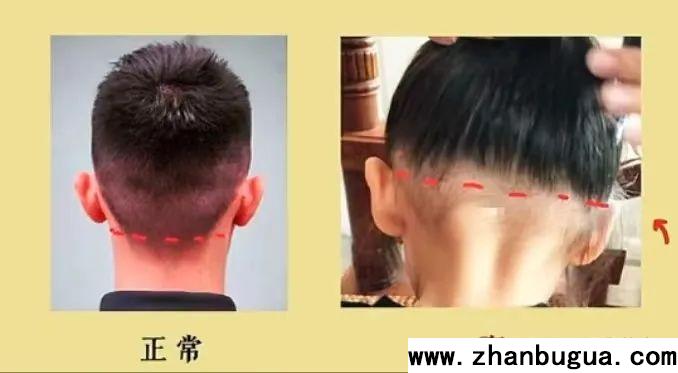 五官相面學——后發際線