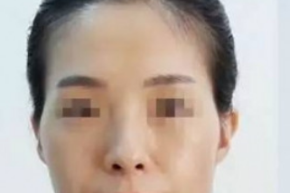 從臉上的婚姻宮看感情