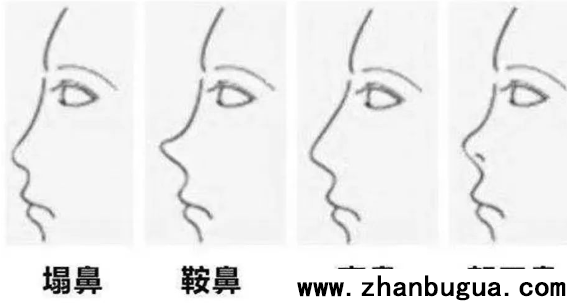鼻相總論