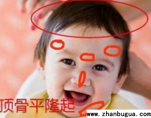 骨相：六骨隆起，富貴天齊
