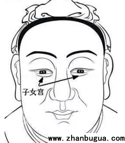 面相吉痣與兇痣